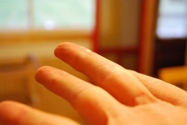 Far schioccare le dita della mano può portare ad una riduzione del senso di dolore