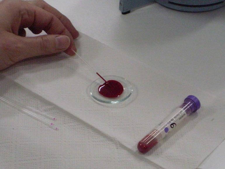 Un’analisi del sangue permetterà di scoprire l’età biologica