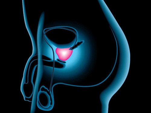 Gli integratori aumentano il rischio di tumore alla prostata