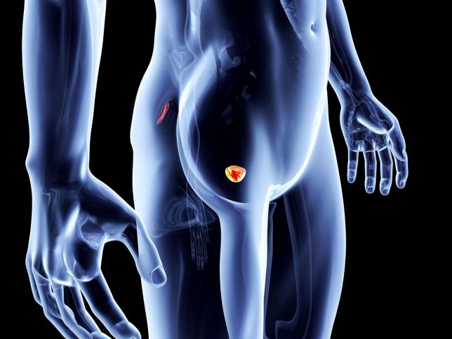 tumore-alla-prostata-1.jpg