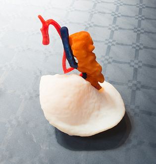 Stampa-3D-le-nuove-frontiere-della-medicina-gli-organi-artificiali-1.jpg