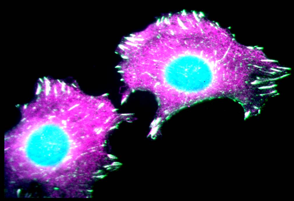 Cancro, super microscopio per immagini in 3D delle cellule tumorali