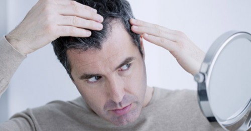 Caduta dei capelli: come combatterla con l’alimentazione