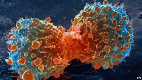 Cosa provoca il cancro? Ecco i fattori più rischiosi
