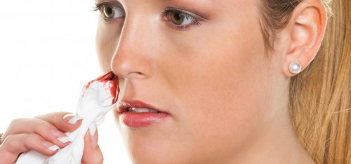 Sangue dal naso: potrebbe essere una malattia genetica