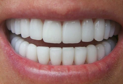 Problemi ai denti: il nuovo metodo per prevenirli