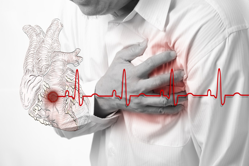 Scompenso cardiaco: sintomi e fattori di rischio