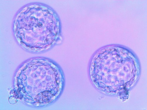 Modificati embrioni umani ‘senza errori’: l’esperimento negli Usa