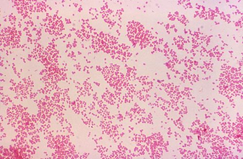 Gonorrea resistente agli antibiotici: l’allarme dell’Oms