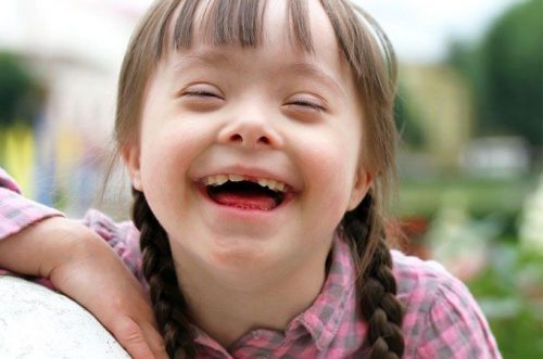 sindrome-di-down-e1503503846588-1.jpg