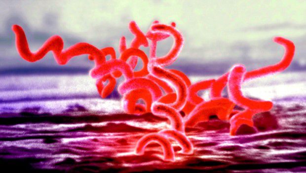 malattie sessualmente trasmissibili sifilide