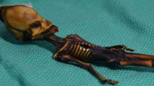 Risolto il mistero dello scheletro ‘alieno’, è umano