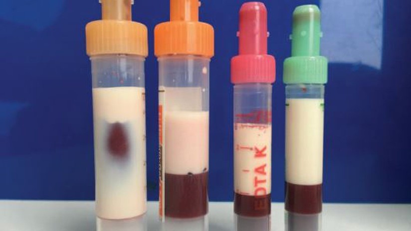 sangue-bianco-1.jpg