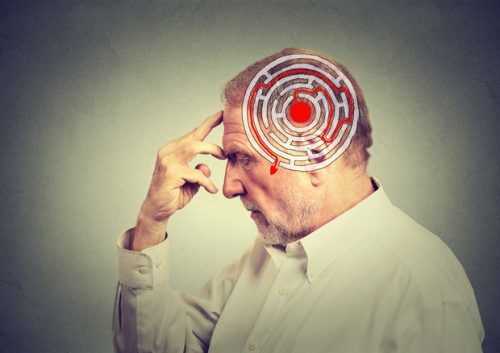 Morbo di Alzheimer: i primi allarmanti sintomi