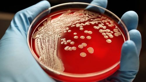 L’alleanza di due batteri ‘mangiacarne’ provoca infezione mortale: il caso