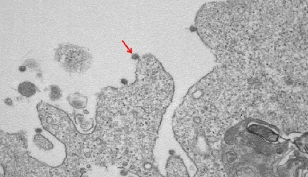 Coronavirus, le prime immagini del Covid-19 “lombardo” isolato a Milano
