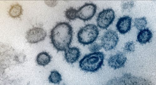 Coronavirus e vaccino di Oxford: non è vero che i macachi si sono ammalati