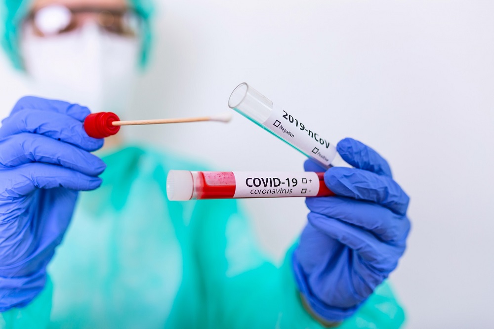 Coronavirus, l’Ordine dei Medici: ”Lockdown totale o sarà il collasso”