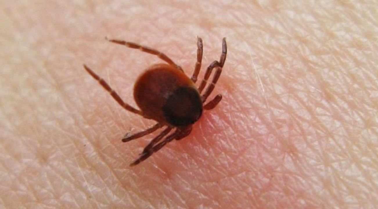 zecche-mordono-uomo-1.jpg