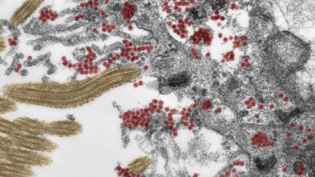 Ecco come il Covid-19 riesce ad ‘entrare’ nel cervello. La scoperta degli scienziati