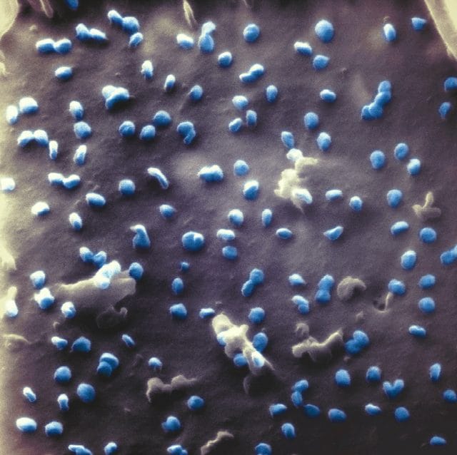 coronavirus-1-1.jpg