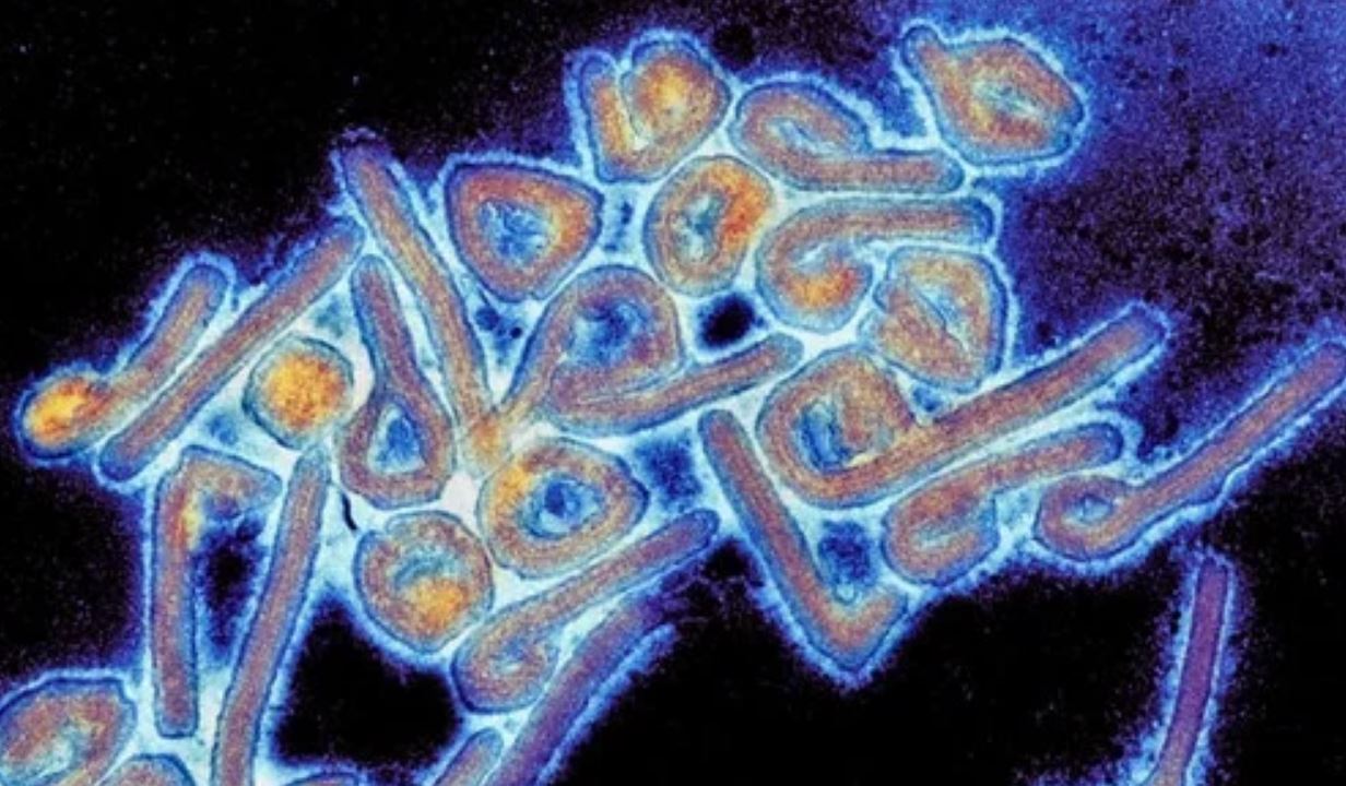 Primo caso al mondo di virus Marburg confermato dall’Oms: un morto per la febbre emorragica