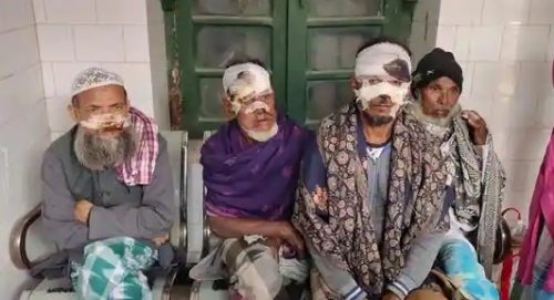 India: sciacallo attacca 40 persone: 8 sono in  gravi condizioni