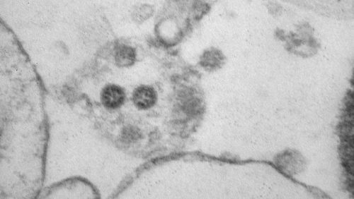 Un laboratorio russo pubblica una ‘microfoto’ della variante omicron del coronavirus
