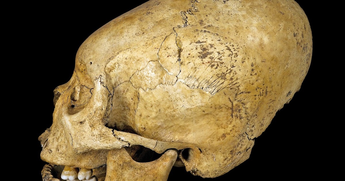Un cavaliere germanico con il cranio deformato scoperto in Toscana
