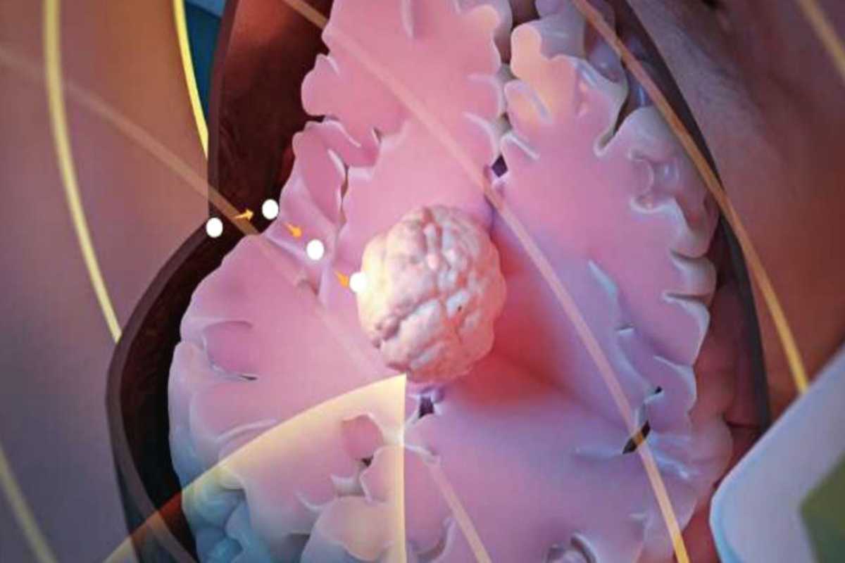 minima-cancro-1.jpg