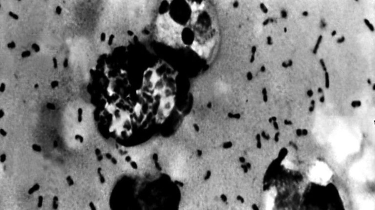 Antico DNA rivela le origini della peste nera