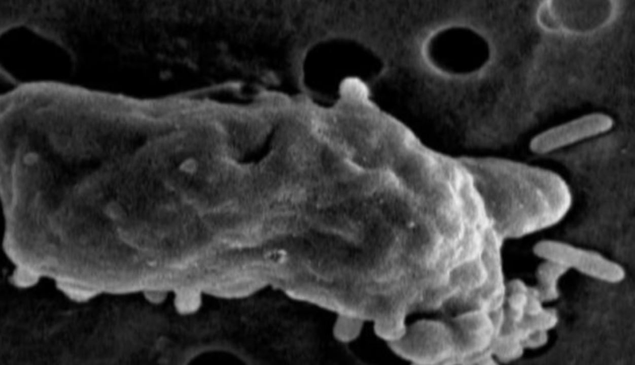 Bagnante infettato dall’ameba mangia-cervello: ecco quali sono i sintomi