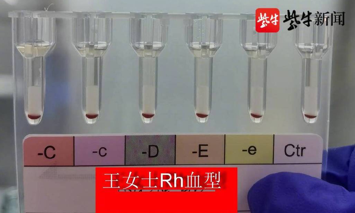 Cina: scoperte due persone dal ‘sangue d’oro’, il gruppo sanguigno più raro al mondo