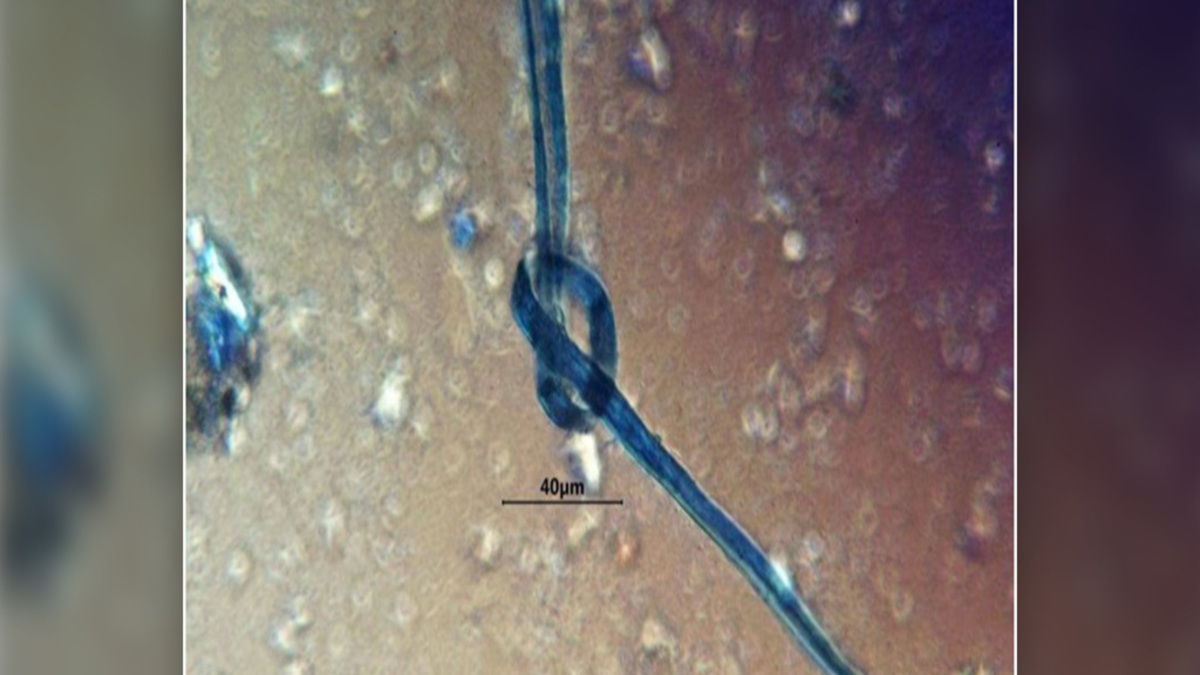 KnottedBlueThread-1-1.jpg