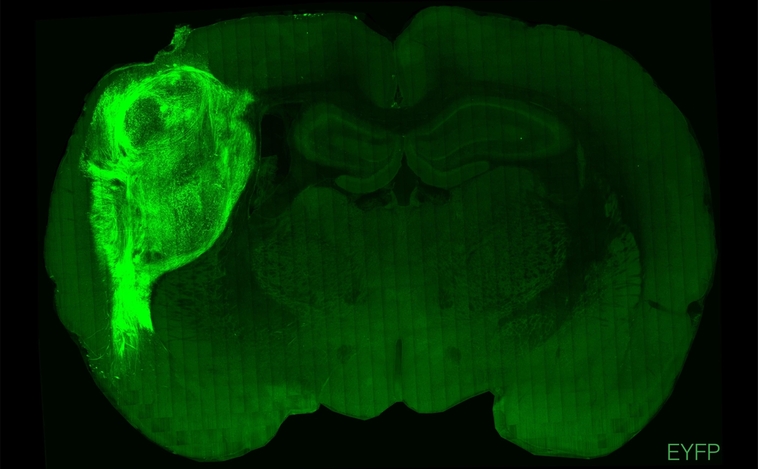 Scienziati inseriscono ‘mini cervelli’ umani nei topi cambiandone il comportamento