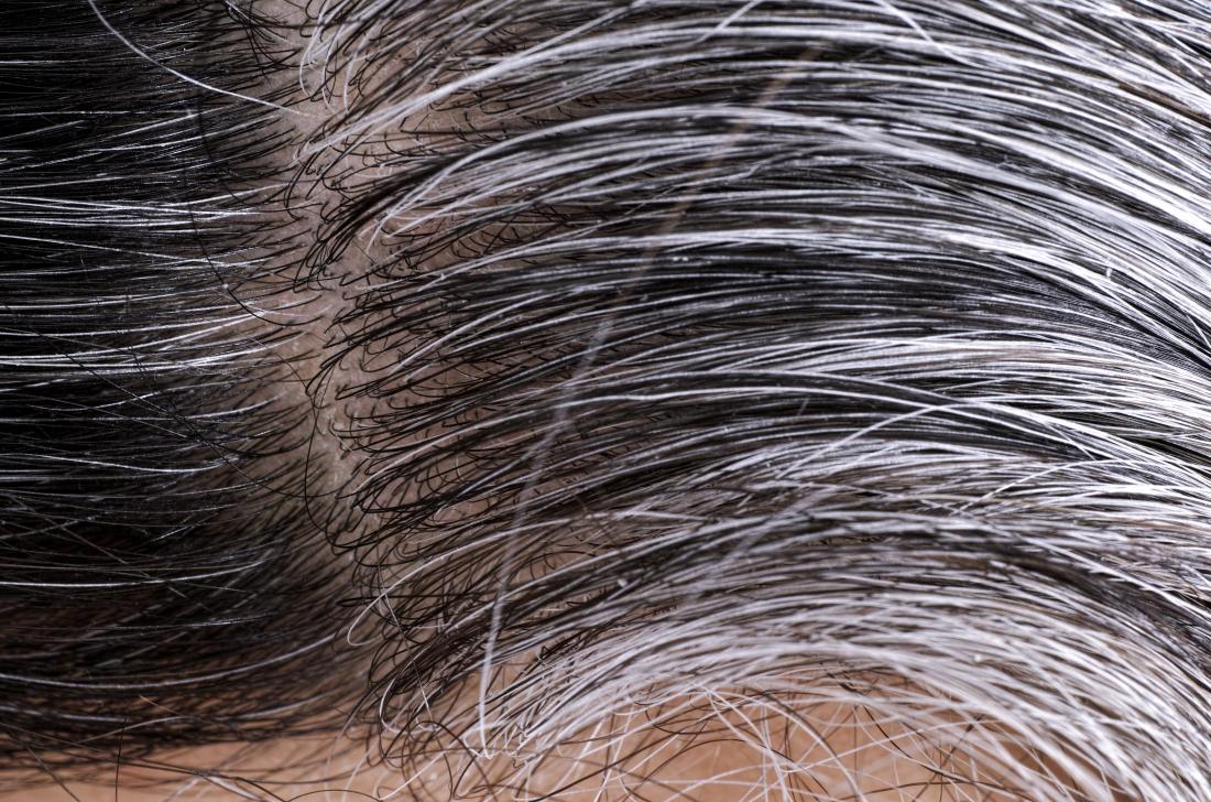 Lo stress è all’origine dei capelli grigi?