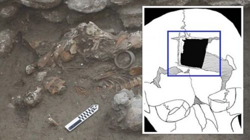 Israele: scoperte prove di chirurgia cranica risalenti a 3.500 anni fa