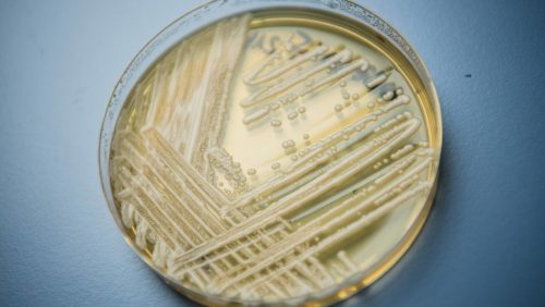 Un’infezione fungina mortale si sta diffondendo a un ritmo “allarmante” in USA