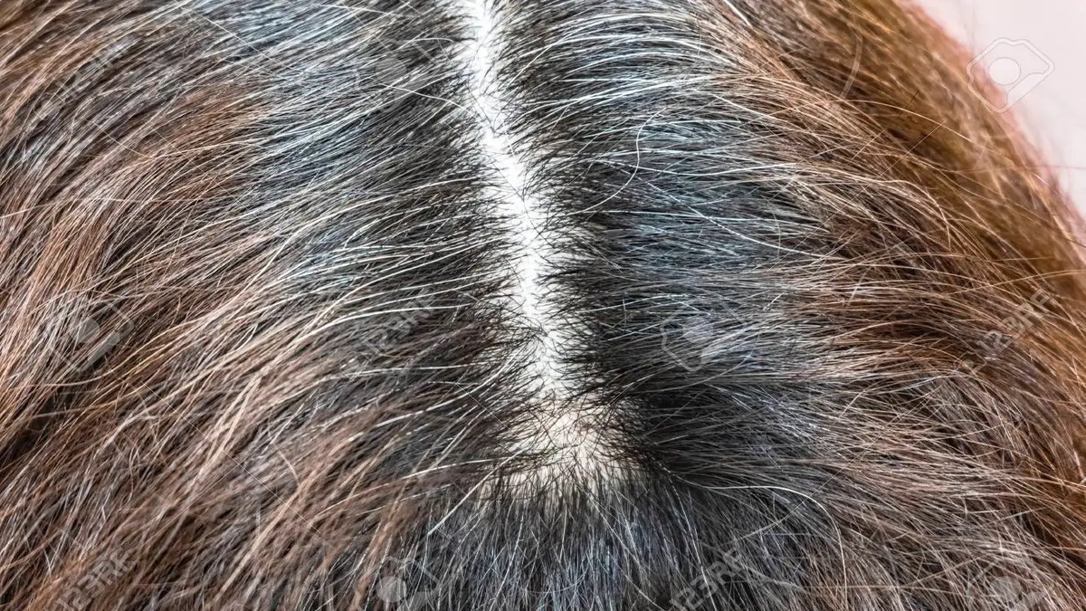 Scienziati hanno scoperto il meccanismo che causa i capelli grigi