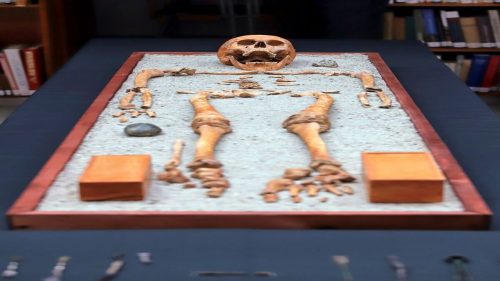 Ungheria: medico dell’epoca romana sepolto con i suoi strumenti chirurgici