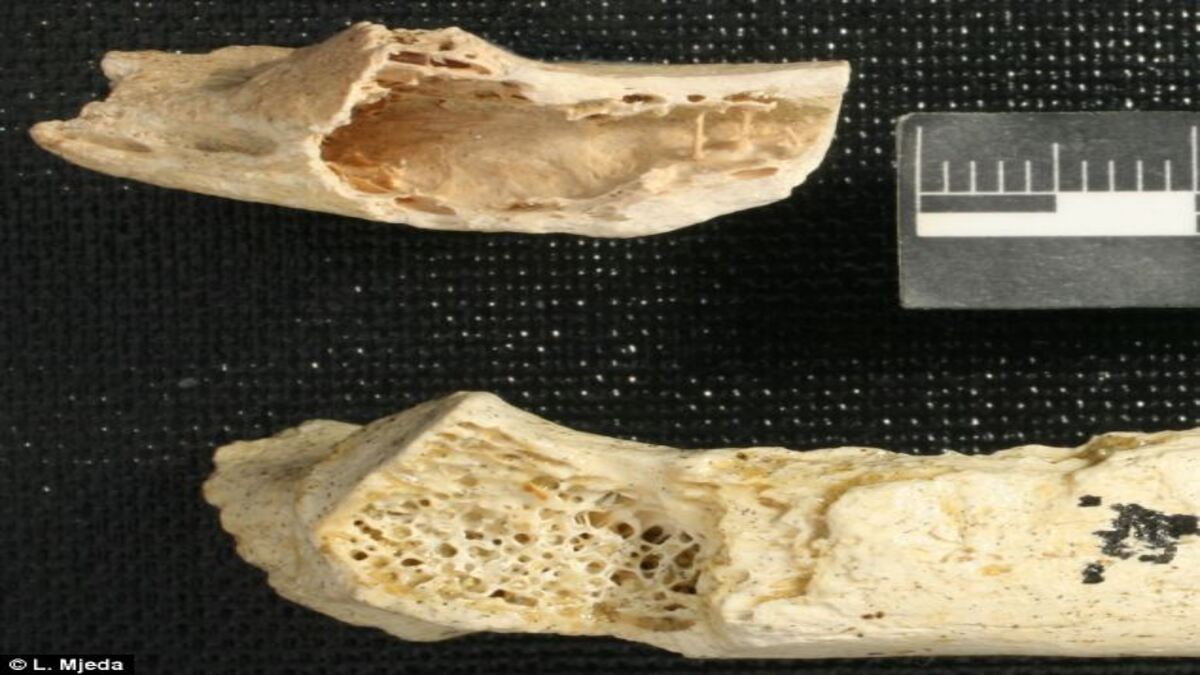 Il tumore osseo più antico al mondo scoperto su un Neanderthal
