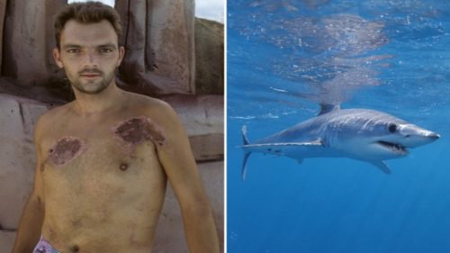 Uomo attaccato da uno squalo afferma di essere stato salvato dai delfini