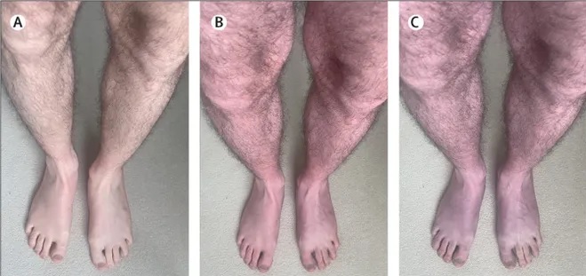 gambe-viola-1.jpg