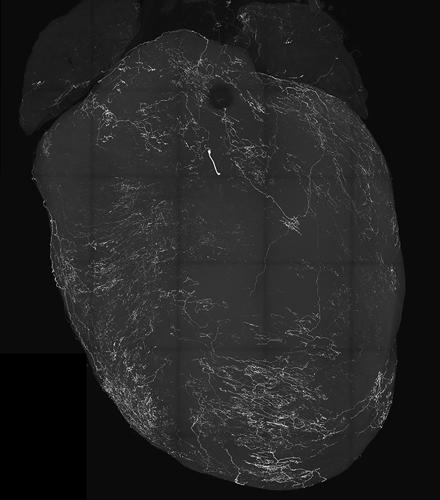immagine in bianco e nero del cuore con i nervi sensoriali vagali mostrati in bianco
