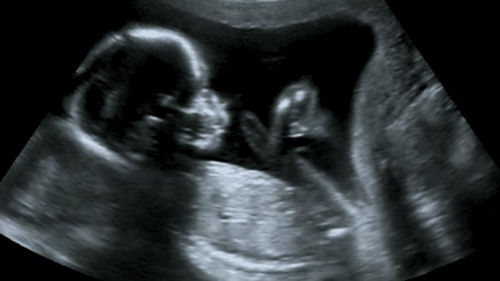 Una scansione ecografica di un feto nell'utero.