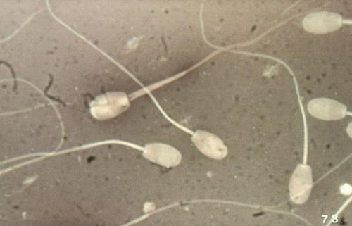 sperm-m-1.png