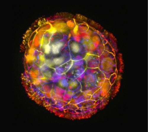 immagine colorata di un anthrobot circolare che mostra il rivestimento di ciglia sulla sua superficie
