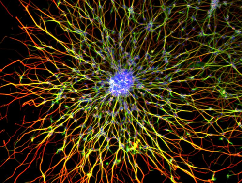 Un gruppo di neuroni in coltura. Questi neuroni si aggregano naturalmente quando vengono posti in coltura formando un cluster di corpi cellulari (blu) che emettono neuriti ricche di microtubuli (rossi e verdi).