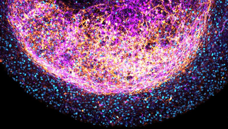 A zoom-in image of a part of a human fetal brain organoid. Stem cells are marked by SOX2 (cyan) and neuronal cells (TUJ1) are color coded from pink to yellow based on depth.