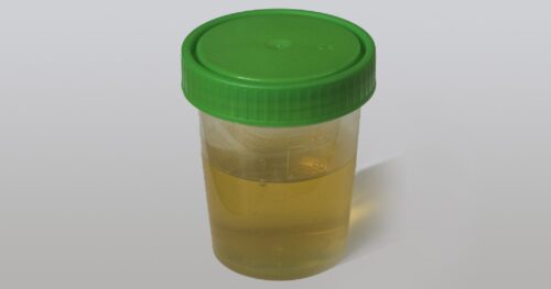 urina